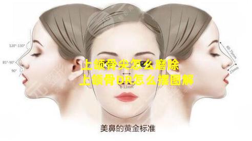 上颌骨尖怎么磨除 上颌骨DR怎么摆图解